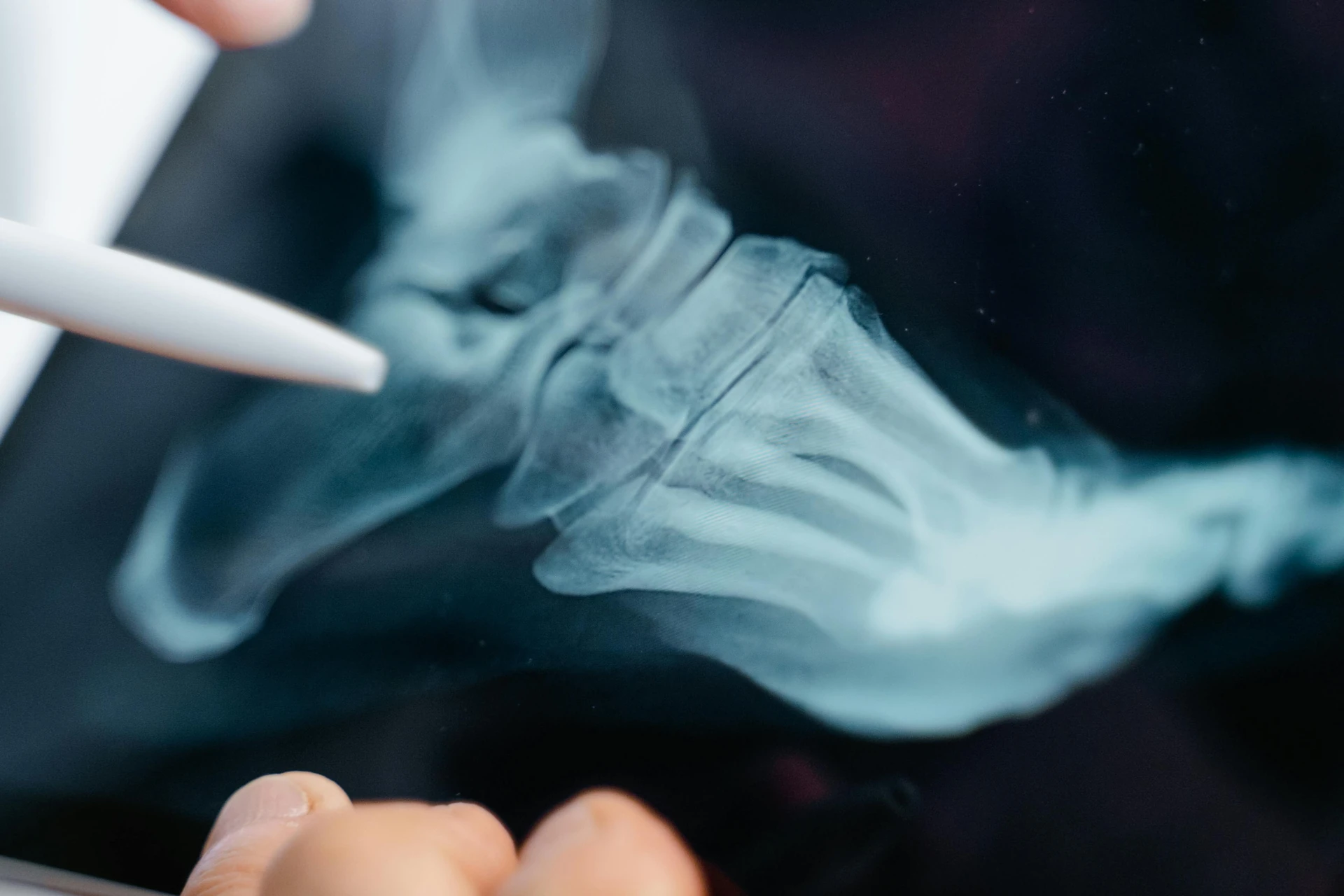Common Orthopedic Conditions and Their Treatments
